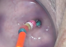 Uterus penetration with objects pumping cervix prolapse