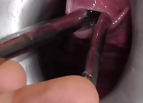 Analslut multiple sounds - james is stretching her urethra back multiple sounds - peeing into her gaping cunt