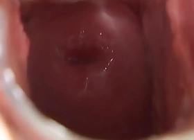 Speculum beauty dildo fucking pussy before spreading cunt