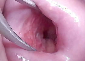 Japanese Wife Candid Cervix Wide to watch medial Uterus